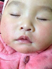 下巴发红图片,探寻健康与美丽之道